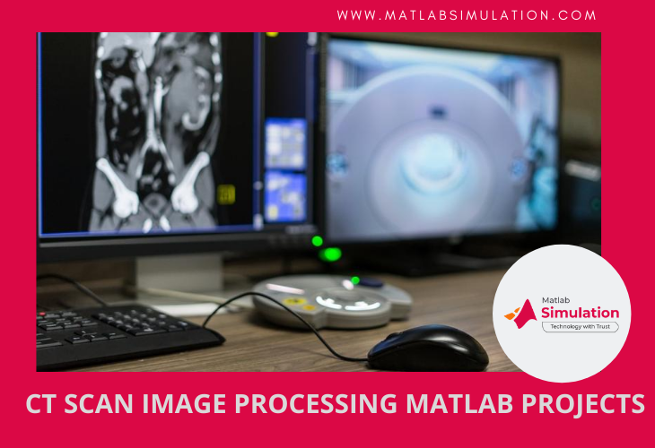 Image Processing Matlab Projects with CT SCAN Technology