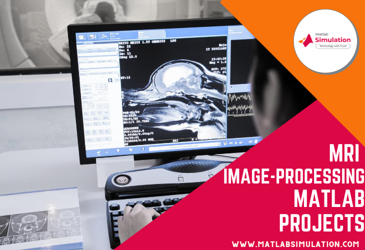 Medical Image Processing MRI using Matlab Projects